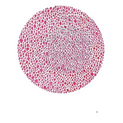 An Abundance of Strawberries