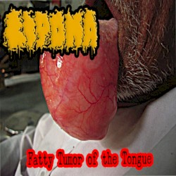 Fatty Tumor of the Tongue