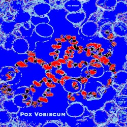 Pox Vobiscum