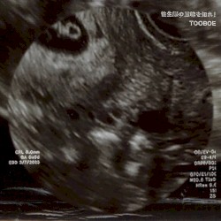 往生際の意味を知れ!