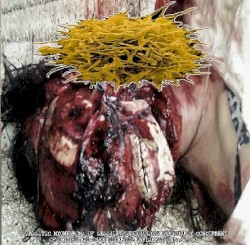 Parasitic Myoneuroma Of Sessile Pseudopolyps Similarly Concurrent Of Decubiteal-Like Ulcerous Inflammation