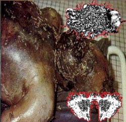 Maggots In A Bloated Corpse / Carcinomas Of Unknown Primary Origin