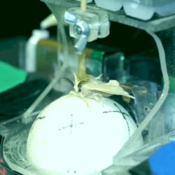 004: Lesson in Dissociation