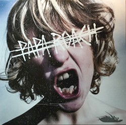 Crooked Teeth