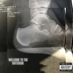 Welcome to the Shitshow