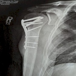 Musick for Healing (Mikoustic version)