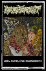 Medical Renditions of Grinding Decomposition