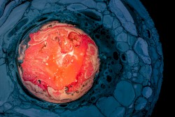 Our Forgotten Infinity and the Absolute Zero