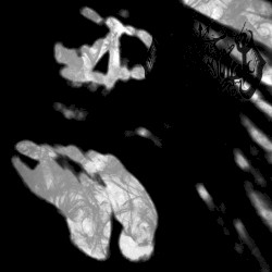 Languor Into Echoes, Beyond