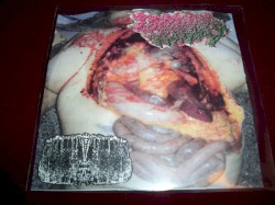 Genital Herpes / Butyric Fermentation Abuse