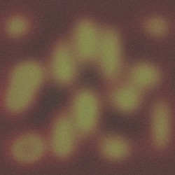 Soisong Broadcast #5