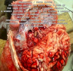 Hebephilia / Fetus Kalops / FxRxCxBxTxAxPxIxTxLxOxRxPx / Diarrhea Tsunami / AxMxPxHxFxIxHxSxAx / Carcinomas Of Unknown Primary Origin / Mutilated Infant / SxCxAxTx / Perforated Bowel Syndrome With Oozing Faeces / UxDxXxMxGxSx