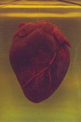 Cardiac Arrest