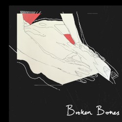Broken Bones