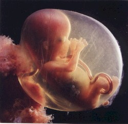 Symphonie pour foetus II