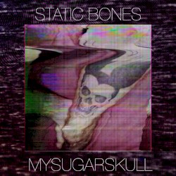 Static Bones