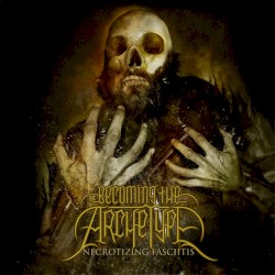 Necrotizing Fasciitis