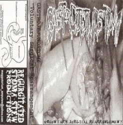 Voluntary Surgical Rearrangement