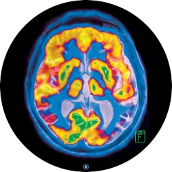 Brainscan