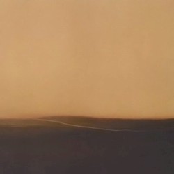 Pure Tone Audiometry