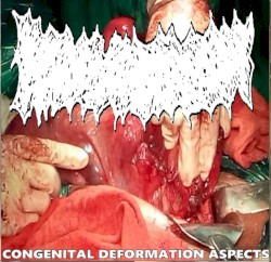 Congenital Deformation Aspects