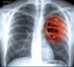 L'estinzione di un colloquio amoroso