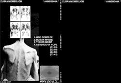 Anhedonia