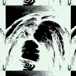 b̷rokecœur;arrhythmia