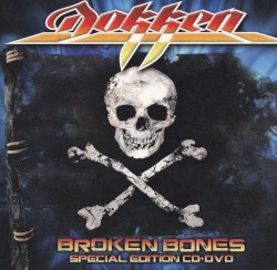 Broken Bones