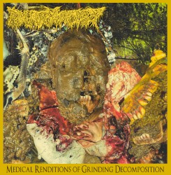 Medical Renditions of Grinding Decomposition