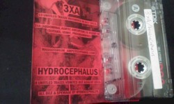 3XA / Hydrocephalus