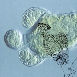 Pseudoceloma