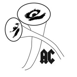 Afterhüttn (Remixes)