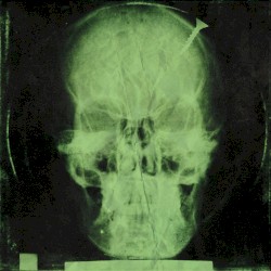 Световъртеж (С Нира)