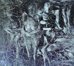 Tooth, Teeth, Milk, Teeth, Skin