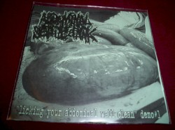 Licking Your Abdominal Wall Clean
