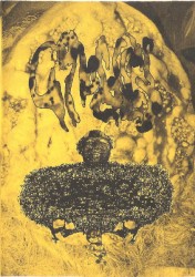 Severe Gonococcal Infection Of The Pus Filled Urinary Tract