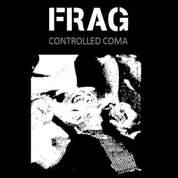 Controlled Coma
