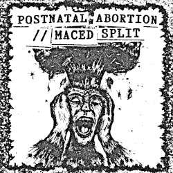 Maced / Postnatal Abortion