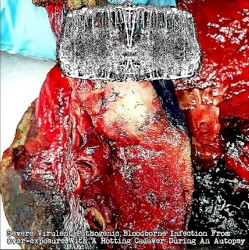 Severe Virulent Pathogenic Bloodborne Infection From Over-exposure With A Rotting Cadaver During An Autopsy