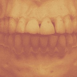 Million Dollar Smile