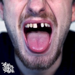 Drugs, Booze & Dental Issues