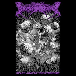 Space Adaptation Syndrome