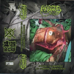 Medical Malpractice and Surgical Extremities