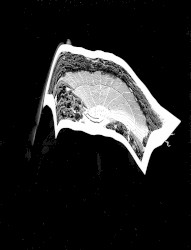 Selective Hearing / 3 Teeth For 1