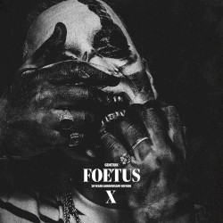 Foetus
