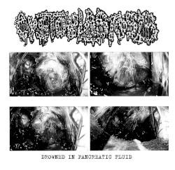 Drowned In Pancreatic Fluid (Demo)