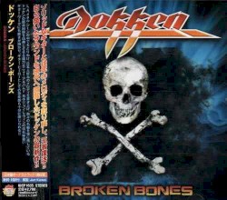 Broken Bones