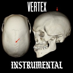 Vertex Instrumental