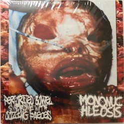 Perforated Bowel Syndrome With Oozing Faeces / Mononuchleosis